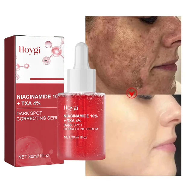 Dark Correcting Essence / 10% Niacinamide+ 4% Tranexamic For Post-Acne Marks Acne Hyperpigmentation And Even Skin Tone Serum