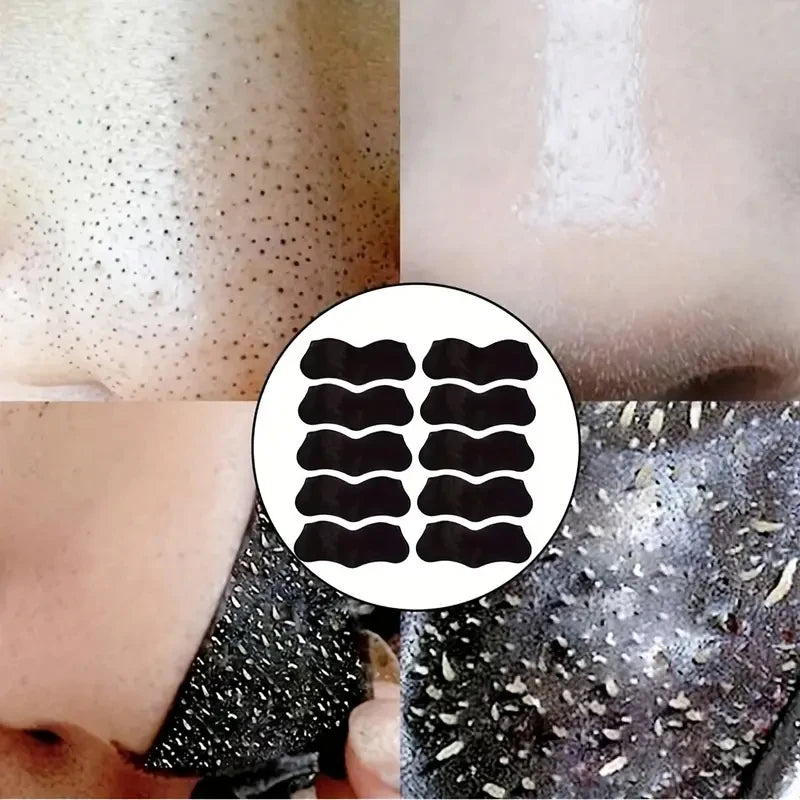 Bamboo Charcoal Blackhead Remover Mask Nasal Strips Black Dots Spots Acne Treatment Mask Face Acne Deep Clean Nose Sticker