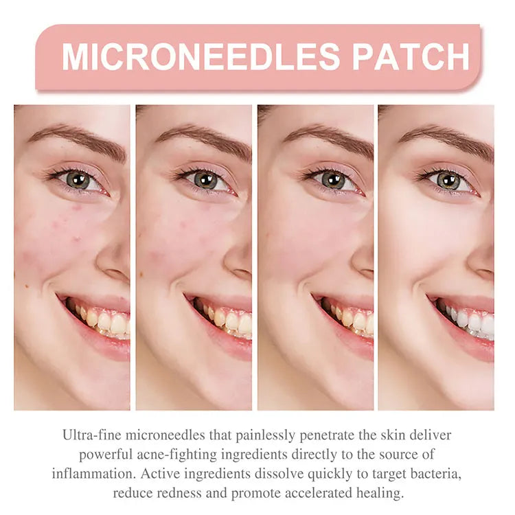 Pimple Patch Invisible Beauty Concealer Breathable Face Care Gentle Non-Irritating Purifying Pores Portable Transparent