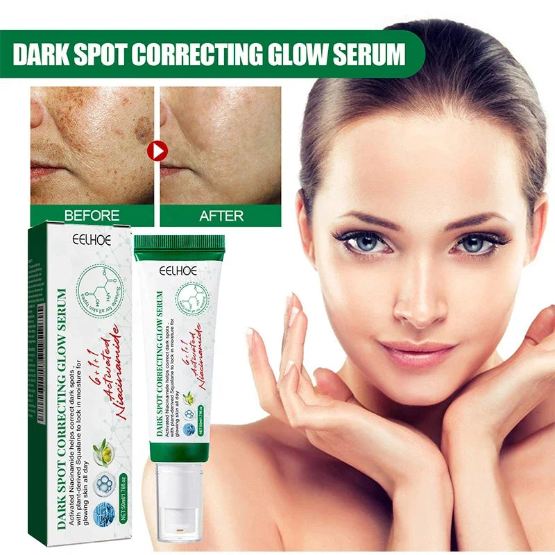 Dark Spot Correcting Glow Serum,Facial Skin Moisturizing Brightening Whitening Cream,Reduce Freckles, Dullness,Acne,And Melanin