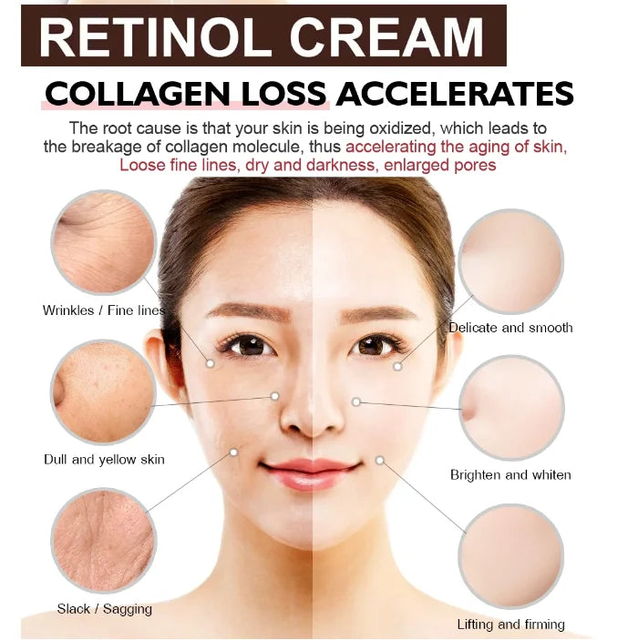 Retinol Wrinkle Remover Face Cream Firming Lifting Anti Aging Fade Fine Lines Moisturizing Whitening Skin Care Korean Cosmetics