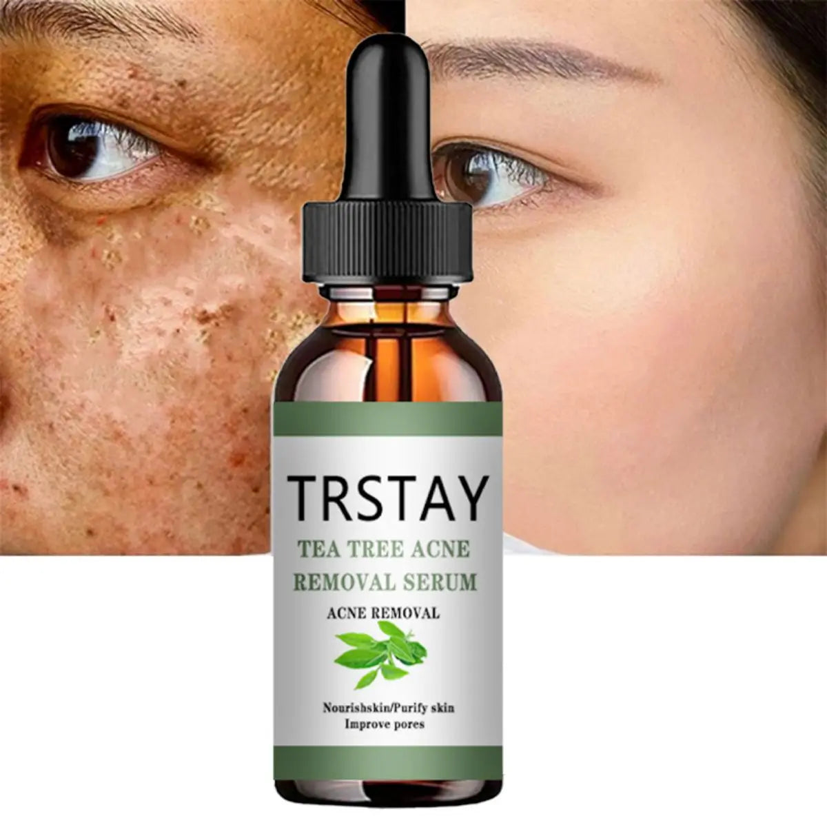 Acne Treatment Face Serum Tea Tree Oil Essence Moisturizing Shrink Pores Acne Facial Serum Korean Skin Care Products