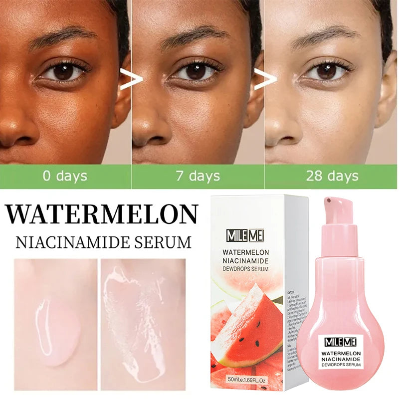 Watermelon Nicotinamide Bulb Essence Glow Recipe Cosmetics Moisturizing Lotion Essence Whitening And Brightening Skin Makeup