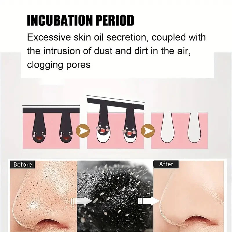 Bamboo Charcoal Blackhead Remover Mask Nasal Strips Black Dots Spots Acne Treatment Mask Face Acne Deep Clean Nose Sticker