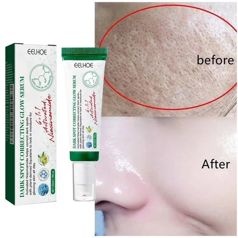 Dark Spot Correcting Glow Serum,Facial Skin Moisturizing Brightening Whitening Cream,Reduce Freckles, Dullness,Acne,And Melanin