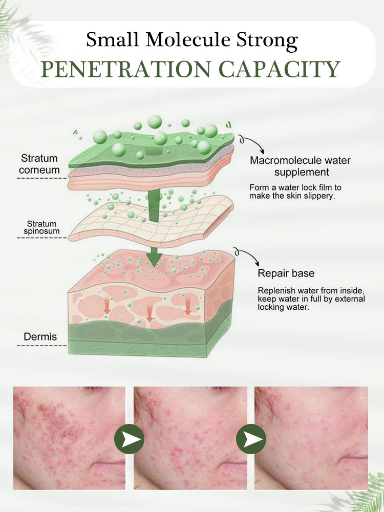 Acne Treatment Face Serum Tea Tree Oil Essence Moisturizing Shrink Pores Acne Facial Serum Korean Skin Care Products