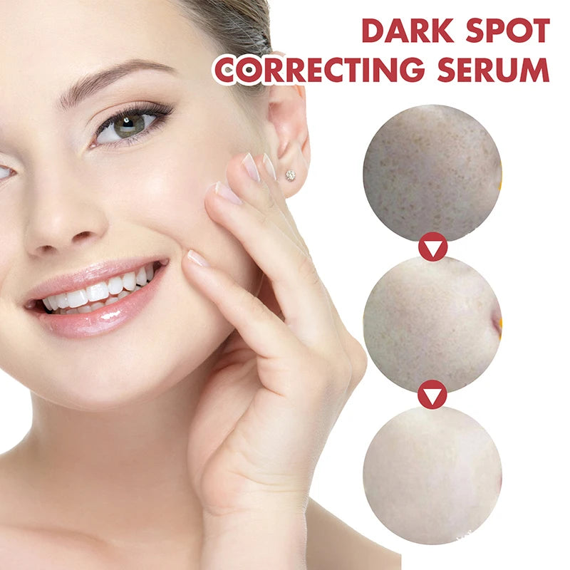 Dark Correcting Essence / 10% Niacinamide+ 4% Tranexamic For Post-Acne Marks Acne Hyperpigmentation And Even Skin Tone Serum