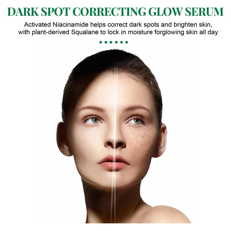 Dark Spot Correcting Glow Serum,Facial Skin Moisturizing Brightening Whitening Cream,Reduce Freckles, Dullness,Acne,And Melanin