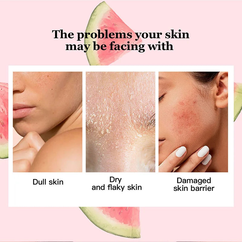 Watermelon Nicotinamide Bulb Essence Glow Recipe Cosmetics Moisturizing Lotion Essence Whitening And Brightening Skin Makeup