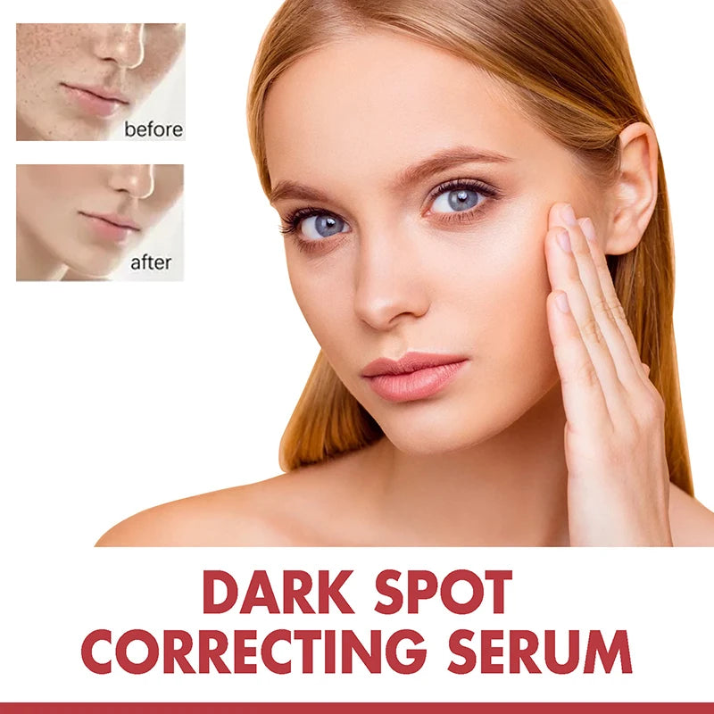 Dark Correcting Essence / 10% Niacinamide+ 4% Tranexamic For Post-Acne Marks Acne Hyperpigmentation And Even Skin Tone Serum