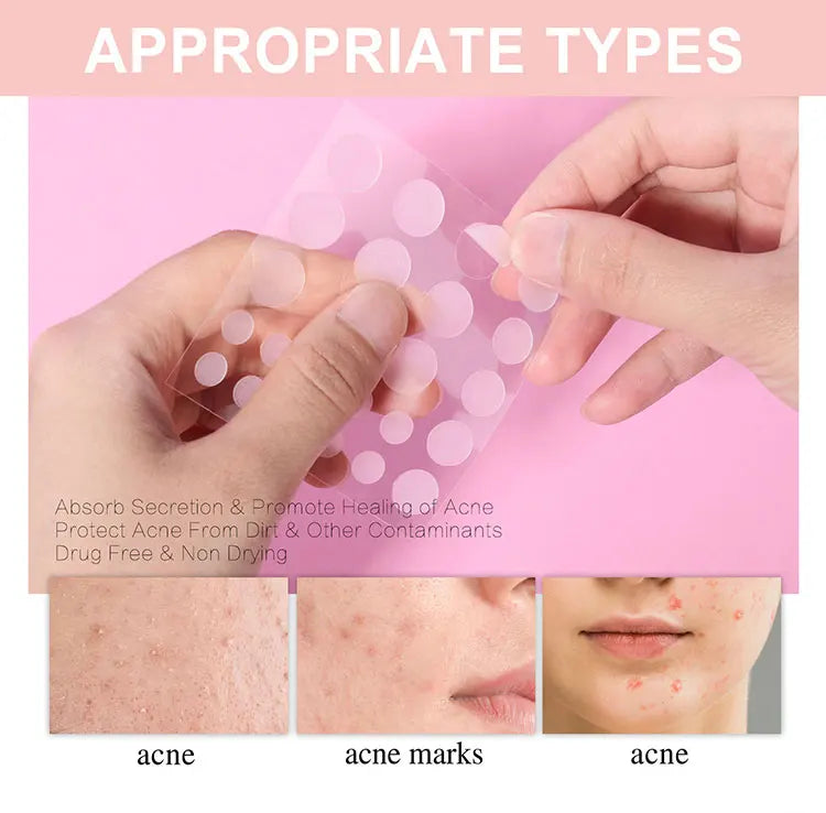 Pimple Patch Invisible Beauty Concealer Breathable Face Care Gentle Non-Irritating Purifying Pores Portable Transparent